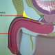 Illustration for article titled The (dubious) science of penis enlargement